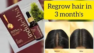 Indulekha bringha scalp serum review in tamil #scalptreatment #haircare
