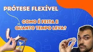 Quanto Tempo Leva para Ficar Pronta uma Pr&oacute;tese Flex&iacute;vel? Descubra o Processo Completo!