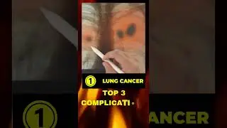 SMOKING COMPLICATIONS #shorts #smoking #complications
