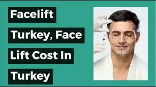 Facelift in Turkey, Face Lift Cost in Turkey, Facelift Turkey Price