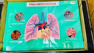 Pneumococcus #anatomy #education #biology #manufacturer #exporter #zsw #biology #lab#medicalcollege 