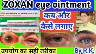 zoxan eye ointment ke fayde | zoxan eye ointment uses in hindi | uses of zoxan eye ointment | ZOXAN