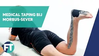 Hoe tape je morbus-Sever | Medical Taping | FysioTape