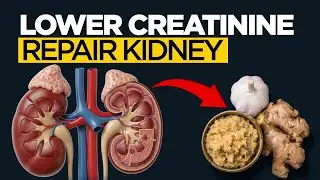 Quickly LOWER Creatinine and IMPROVE Kidney Health Naturally | Reverse Kidney Damage NOW!