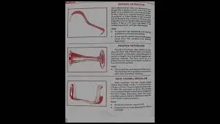 OBG instruments|| instruments used in gynaecology|| #gynecology #instrument