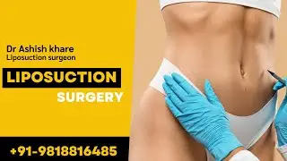 Liposuction Surgery in Delhi: Fat Removal , Liposuction Compression Garments Guide! #liposuction