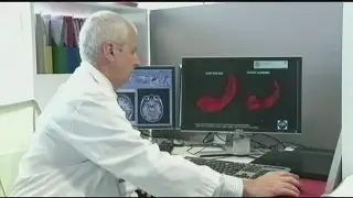 Alzheimer&rsquo;s Disease becoming a greater worldwide problem