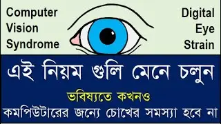 How to avoid Computer use eye problems.#computer #computerEyeProblems #dryEyes #computerEyeStrain