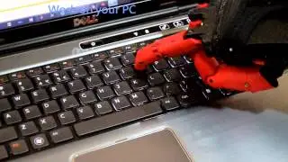 Limbot Myoelectric Bionic Prosthetic Hand