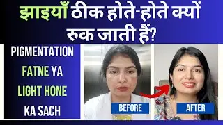 5 Galtiyan Jo Jhaiya Thik Hone Se RoktiHain | Melasma Healing Truth #drvandanaayulab