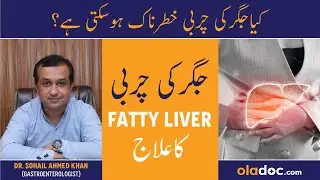 Jigar Ki Caarbi Ka Ilaj - Fatty Liver Disease Causes & Treatment Urdu Hindi