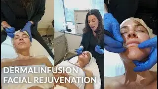 DERMALINFUSION LIVE Treatment | SilkPeel | Microdermabrasion | Dr. Jason Emer