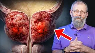 ПРОСТАТА БУДЕТ РАБОТАТЬ КАК МОТОР! СДЕЛАЙТЕ ЭТО УПРАЖНЕНИЕ