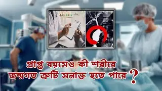 প্রাপ্ত বয়সেও কী শরীরে জন্মগত ত্রুটি সনাক্ত হতে পারে  | Caroli&rsquo;s disease | choledochal cyst