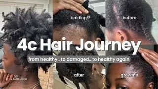 My 4c Hair Journey | how I got my hair back healthy + products + routine + tips & hairstyles