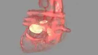 Medical animation of rotating heart