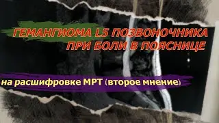 БОЛЬ В ПОЯСНИЦЕ при ГЕМАНГИОМЕ поясничного отдела и СТЕНОЗЕ позвоночного канала на РАСШИФРОВКЕ МРТ