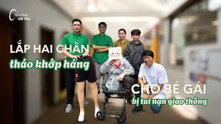 Hoàn thiện 2 chân tháo khớp háng cho bé gái bị tai nạn giao thông | Chỉnh Hình Việt Đức