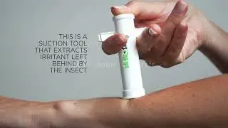 Bug Bite Thing Suction Tool, Poison Remover, 🤔 #suctiontool #poison