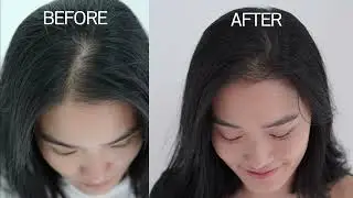 No more bald spot and thinning hair with fenugreek hair treatment oil| the RainTree