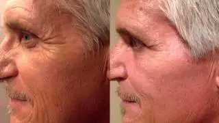 2014 WATCH BEFORE YOU USE NERIUM AD.  JOIN NERIUM INTERNATIONAL Pre Launch in CANADA NOW !