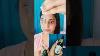 Treat Pimple Marks & Acne Scars | Natural Sure Pores & Marks Facial Oil | #shorts | Saumya's World