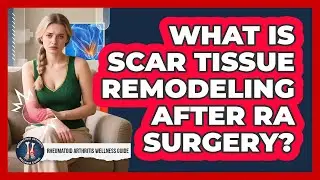 What Is Scar Tissue Remodeling After RA Surgery? - Rheumatoid Arthritis Wellness Guide