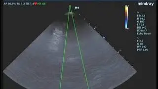 MANDOCDOC, TEOTIMO 01