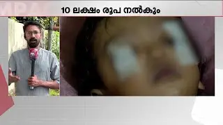 നന്ദി! കുഞ്ഞിന്റെ കണ്ണുകൾ സുഖപ്പെടും; കുട്ടിക്ക് ചികിത്സാ സഹായവുമായി യൂസഫ് അലി | M A Yusuff Ali