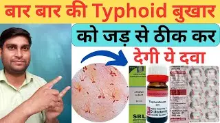 Typhoid Fever : Symptoms, Treatment & Prevention Explained🔥