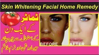 Skin Whitening Facial With Tomato || Home Remedy By Sara Health & Beauty Tips