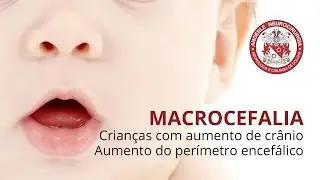 Macrocefalia = Crianças com aumento de Crânio = Aumento do perímetro encefálico  -  Dr Diogo