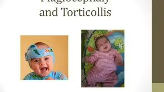 Bouncing Babies: Modern Materials and Their Impact on Development in Infants & Toddlers