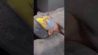 Deep Face Massage Remove Blackhead #facemassage #detoxfacemassage