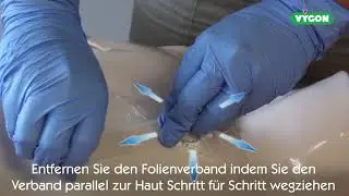 perfusafe 2 - Legen und Ziehen der Sicherheitspunktionskanüle