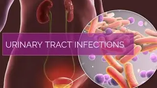 URINARY TRACT INFECTION | USMLE STEP 1 & 2 HIGH YIELD REVIEW | RENAL MEDICINE AND UROLOGY