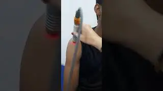 Laser physiotherapy treatment for  Frozen shoulder .              Laser application on athletes also