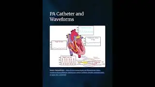 PA Catheters: Waveforms, where it sits, and thermodilution.