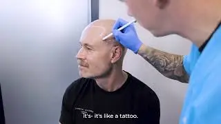 Scalp Micropigmentation (SMP) at Enhance Hair Restoration UK