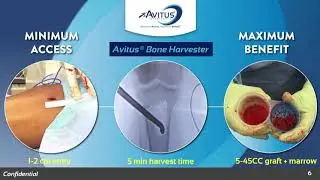 AMP'D Arena Pitch Competition Avitus