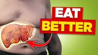 The Science-Backed Diet That Lowers Liver Fat for Seniors