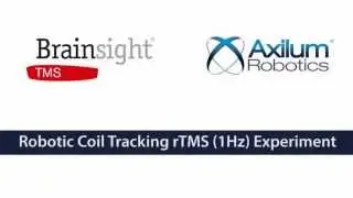 Robotic Coil Tracking rTMS (1Hz) Experiment