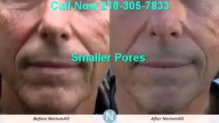 Nerium Skin Care Reviews | 210-305-7833