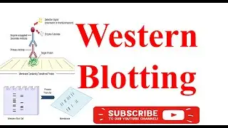 Western Blotting | Clinical Biochemistry #westernblotting #medicalmirobiology #student #medical #1st