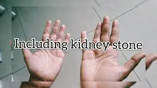 Kidney Mudra to Solve Kidney Problems
