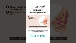 [Bexcore] Vacuum Assisted Breast Biopsy System - VABB/VABE Procedure