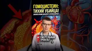 Homocysteine: Myth or Reality in Cardiology