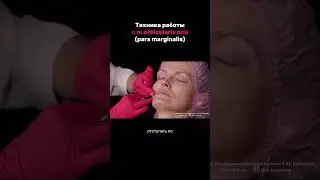 Техника работы с m.orbicularis oris (pars marginalis) #инъекционнаякосметология #ботулинотерапия