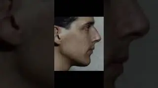Доктор Майк Мью, 3 года лечения #мьюинг