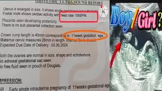 11 weeks pregnancy scan report/ NT scan ( boy/girl ) ?🤵👸